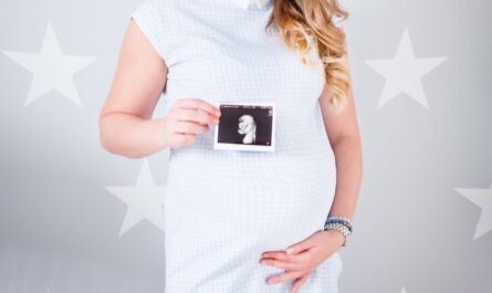 woman wearing white cap sleeved dress holding ultrasound result photo